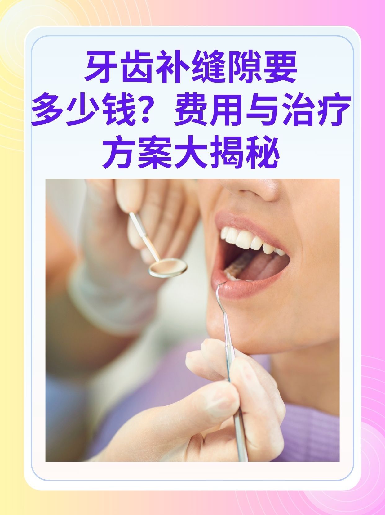 贵阳补牙医保可以报销吗(补牙医保可以报销吗 哪些可以报销呢)